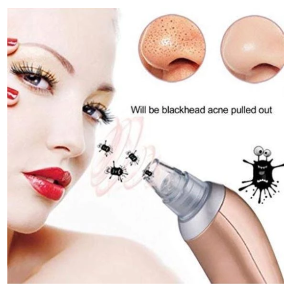 Black Head Remover