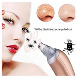 Black Head Remover