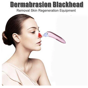 Black Head Remover